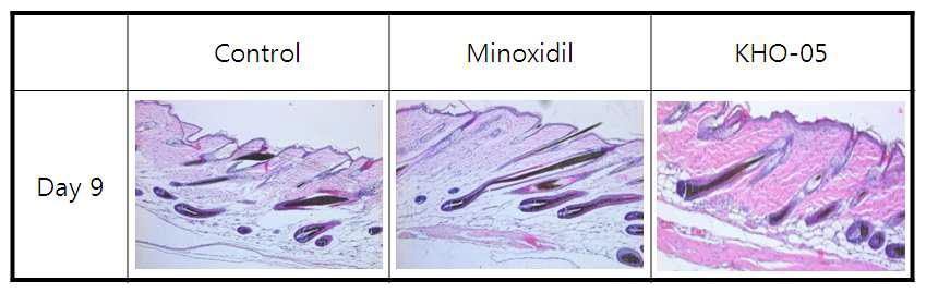 C57BL/6 마우스에서 KHO-05에 의한 모발 성장 변화의 조직학적 관찰
