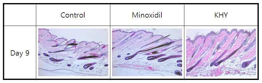 C57BL/6 마우스에서 KHY에 의한 모발 성장 변화의 조직학적 관찰