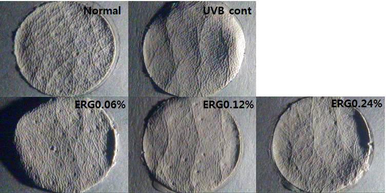 UVB를 조사한 광노화 무모생쥐에 효소처리 홍삼 소재를 0.06%, 0.12% 및 0.24%의 농도로 배합한 식이 섭취 후 주름 형성에 미치는 효과. (Normal) 자외선 무처리군 (UVB control) 자외선 조사군 (ERG0.06%) 자외선조사+효소처리홍삼0.06% (ERG0.12%) 자외선조사+효소처리홍삼0.12% (ERG0.24%) 자외선조사+효소처리홍삼0.24%