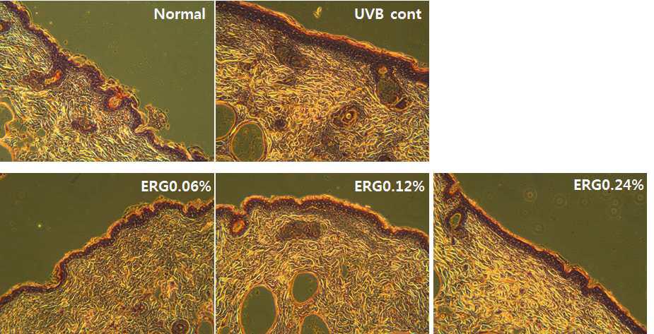 UVB를 조사한 광노화 무모생쥐에 효소처리홍삼 소재를 0.06% 0.12% 및 0.24%% 농도로 배합한 식이 섭취후 H&E 염색법을 이용하여 표피 두께를 관찰한 결과