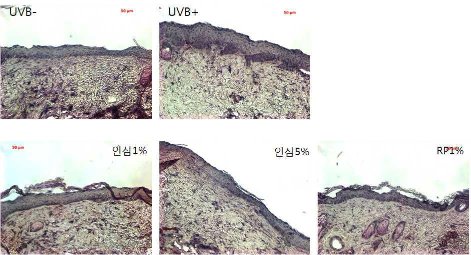 UVB를 조사한 광노화 무모생쥐에 효소처리 인삼 소재를 1 및 5%의 농도로 처리하여 표피 두께를 관찰한 결과