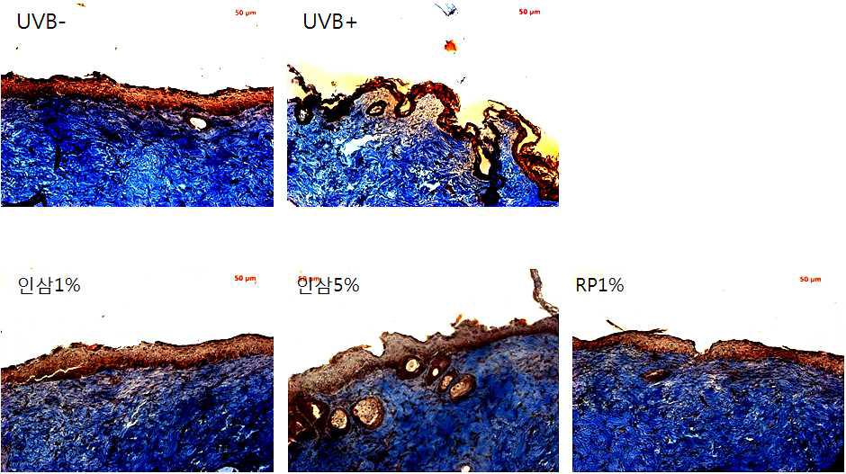 UVB를 조사한 광노화 무모생쥐에 효소처리 인삼 소재를 1 및 5%의 농도로 처리하여 피부 조직 내 콜라겐 변화를 관찰한 결과