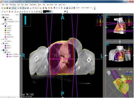 Fig. 5. CBCT based dose calculation results using CorePlan® system.