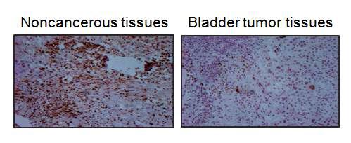 정상조직과 방광암 조직에서의 mH2A1의 발현을 IHC를 이용하여 측정