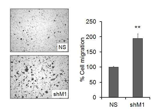 mH2A1 결핍에 의한 세포 migration 증가