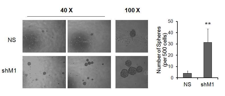 NS와 shM1 세포를 sphere culture medium에서 키우면서 sphere 형성능을 조사