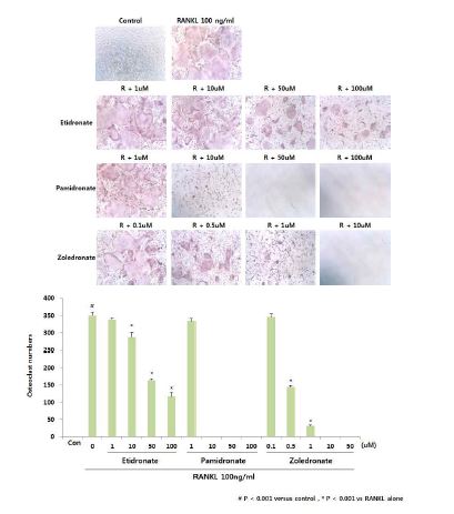 Fig. 17. Effects of bisphosphonates on RANKL-induced osteoclast differentiation in mouse bone marrow macrophages
