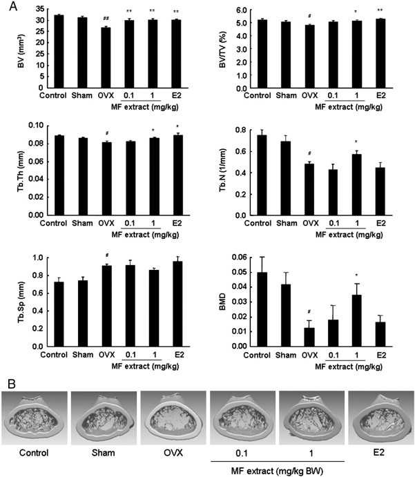Fig. 30. Effects of MF extract on bone morphometric parameters in OVX mice