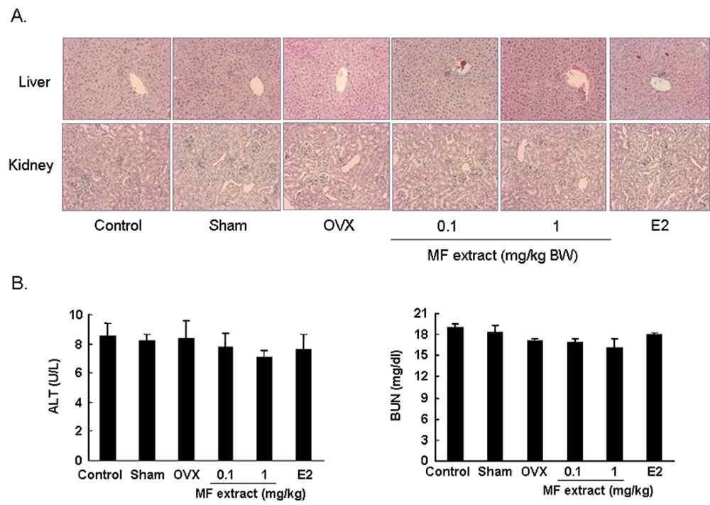 Fig. 31. Nephrotoxicity and hepatotoxicity in MF extract-treated OVX mice