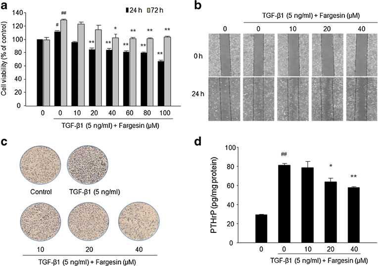 Fig. 39. Effects of fargesin on invasive potential and PTHrP production of TGF-beta-stimulated MDA-MB-231 breast cancer cells
