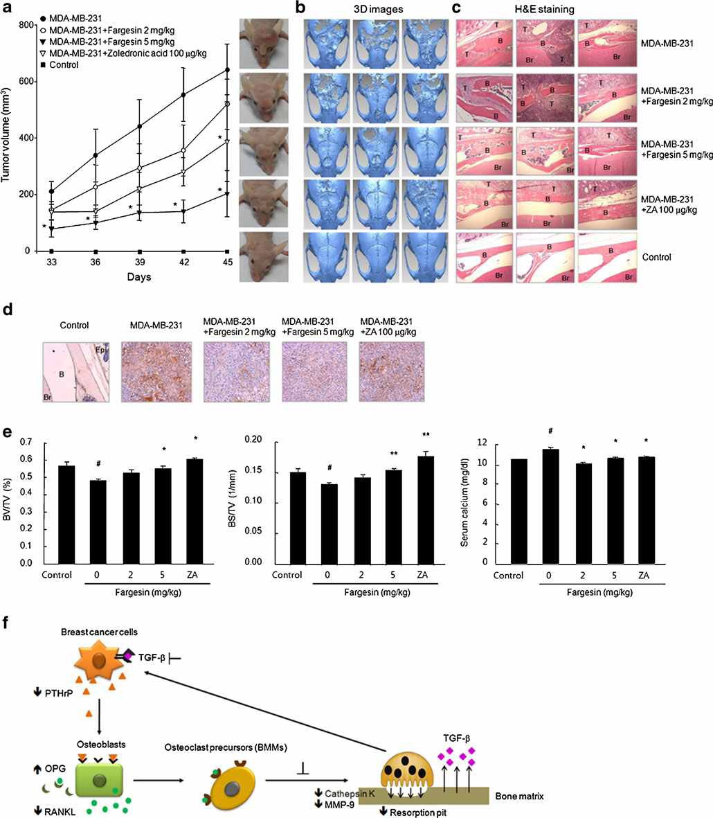 Fig. 43. Effect of fargesin on tumor growth and bone destruction in mice with MDA-MB-231 cells inoculated into calvarial tissues