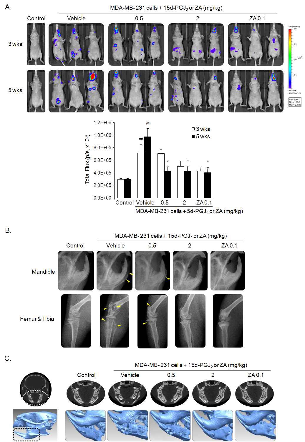 Fig. 47. Effect of 15d-PGJ2 on osteolytic bone metastasis in nude mice with intracardiac injection of MDA-231/Luc+cells