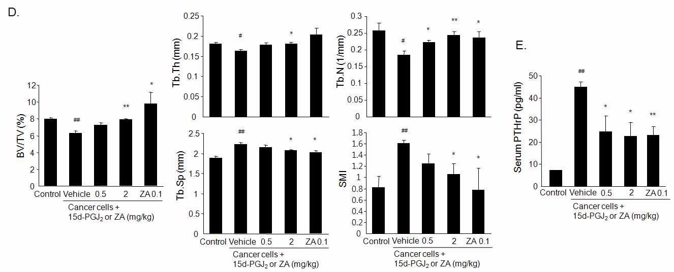 Fig. 47. Effect of 15d-PGJ2 on osteolytic bone metastasis in nude mice with intracardiac injection of MDA-231/Luc+cells