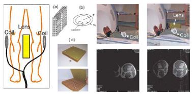 그림 7. MRI 촬영시 보조 렌즈를 이용하여 해상도를 향상 시키는 기술