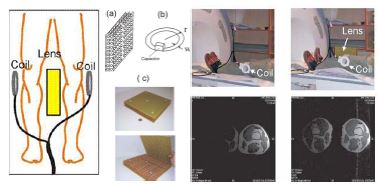 그림 116. MRI 촬영시 보조 렌즈를 이용하여 해상도를 향상 시키는 기술