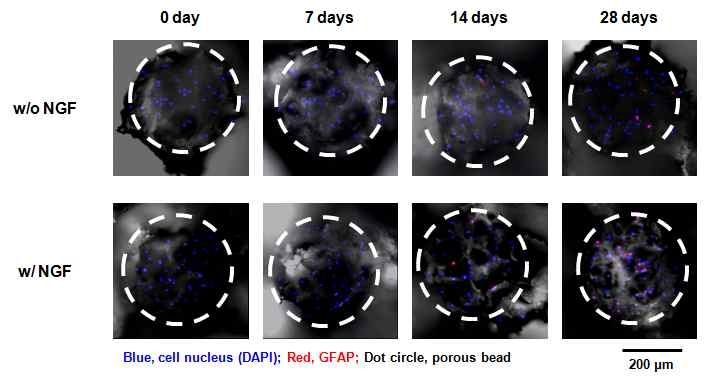 NGF가 탑재된 다공성 구형입자에서의 근육줄기세포의 신경세포로의 분화 거동 (Immunohistochemical staining)