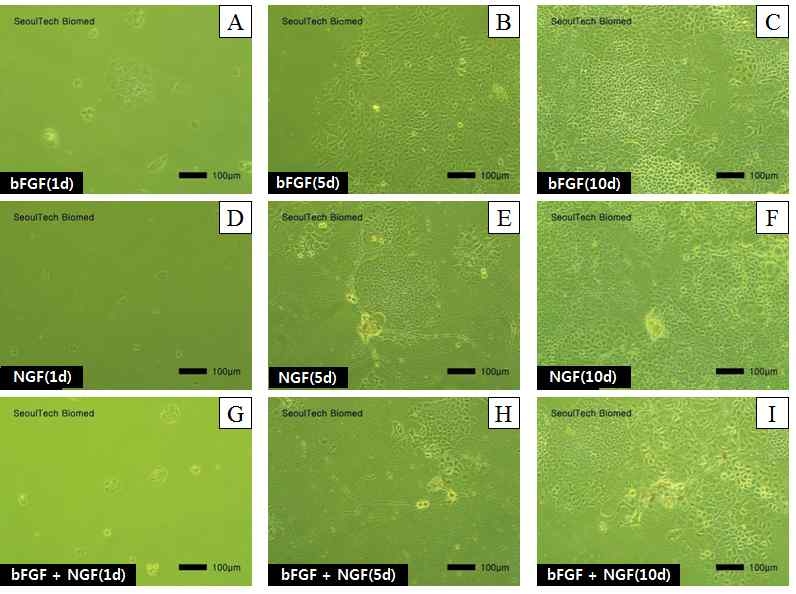 HA 겔로부터 방출된 NGF 및 bFGF에 의한 PC-12 세포의 morphology 관찰 결과. 80ng basic FGF (A, B, C) 320ng NGF(D, E, F), 40ng basic FGF+160ng NGF(G, H, I) for 10 day.
