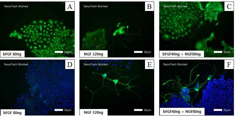 HA 겔로부터 방출된 NGF 및 bFGF에 의한 PC-12 세포의 morphology 관찰 결과. Live & dead assay (A, B, C) β-Ⅲ tubulin staining( D, E, F)