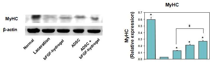 근세포 내 근기능 관련인자인 MyHC발현