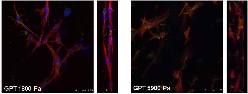 섬유아세포(fibroblasts)의 하이드로겔 내부에서의 퍼짐 및 증식능 평가