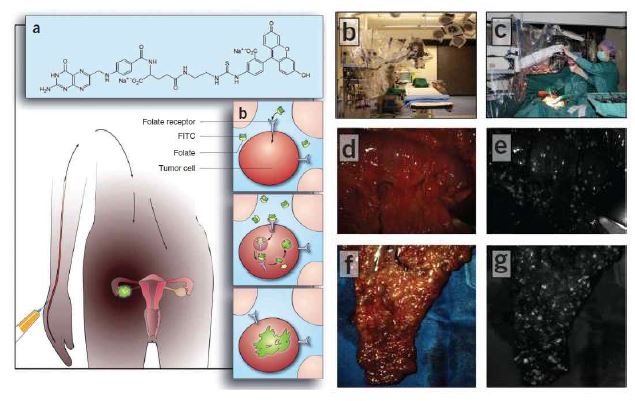 암표적성 형광 조영제 Folate-FITC를 이용한 난소암 형광조영 모식도 (좌) 및 임상적용사진(우)