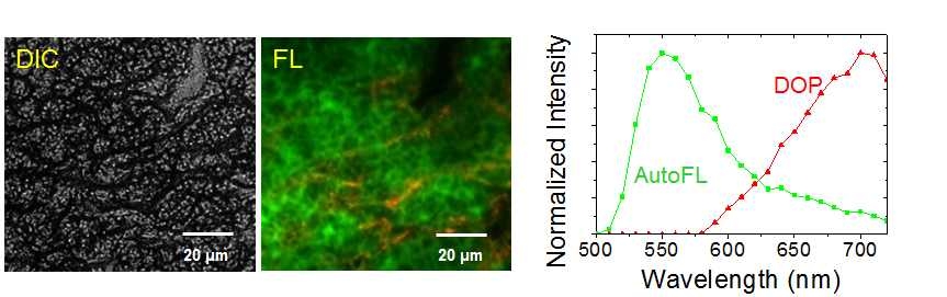 절개된 림프절 조직의 광학/형광 영상(좌)과 형광스페트럼(우)