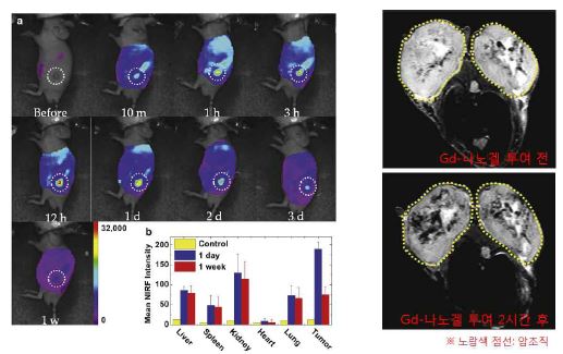 (좌)Gd-나노겔이 정맥 주사된 암 모델 쥐의 시간의 변화에 따른 근적외 형광 영상 및 적출된 주요장기에서의 근적외 형광세기 비교 그래프. (우) Gd-나노겔이 정맥 주사된 암 모델 쥐의 자기 공명 영상