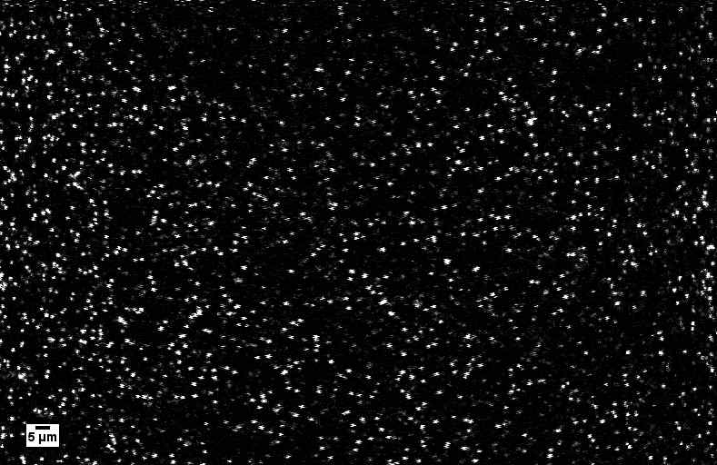 나노선 신경소자 상에서 생성된 실리콘 나노와이어 이미지.