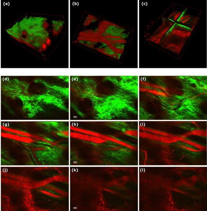 마우스(C57BL/6) 귓바퀴 피부 조직 3차원 이미지 (a-c)와 단층 이미지 (d-l). 초록색은 콜라겐 파이버를 붉은색은 혈관과 연골 구조를 나타냄.
