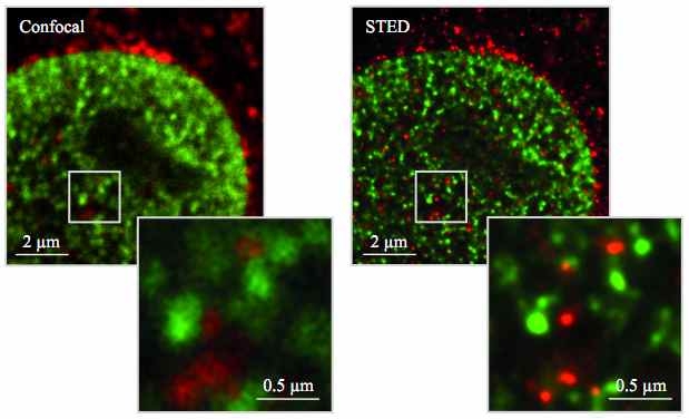 Two-color confocal image와 pulsed STED image