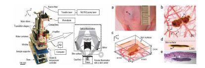 실험 장치 구성 및 B 16- melanoma의 In vivo 광음향 이미지