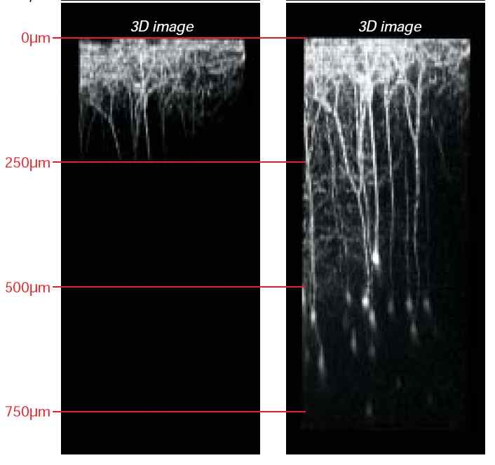 공초점 현미경과 Two photon 현미경을 이용하여 획득한 형질전환 쥐(transgenic mouse(GFP))의 대뇌피질(celebral cortex) 이미지 비교.