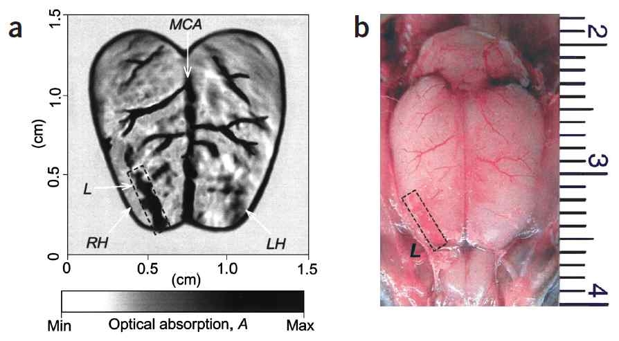 광음향 효과를 이용한 쥐의 대뇌 이미지(좌)와 측정 후 실제 찍은 사진(우) (X. D. Wang, et al., Nat. Biotechnol. 21, 803, 2003)