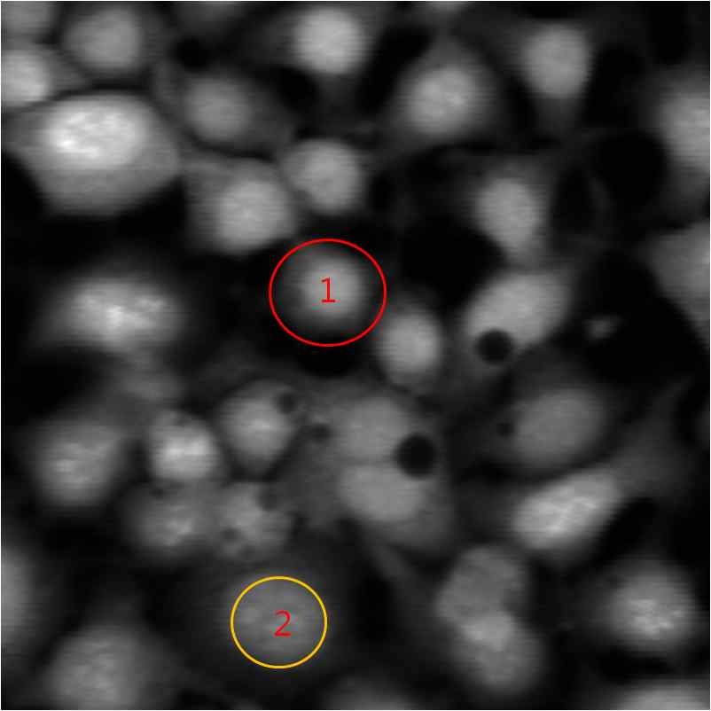 NCI-H292 Cell의 이광자 흡수/형광 이미지