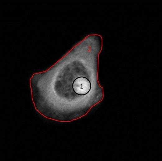 Fluo-4/AM으로 염색된 배양된 middle ear cell의 다광자 현미경 이미지