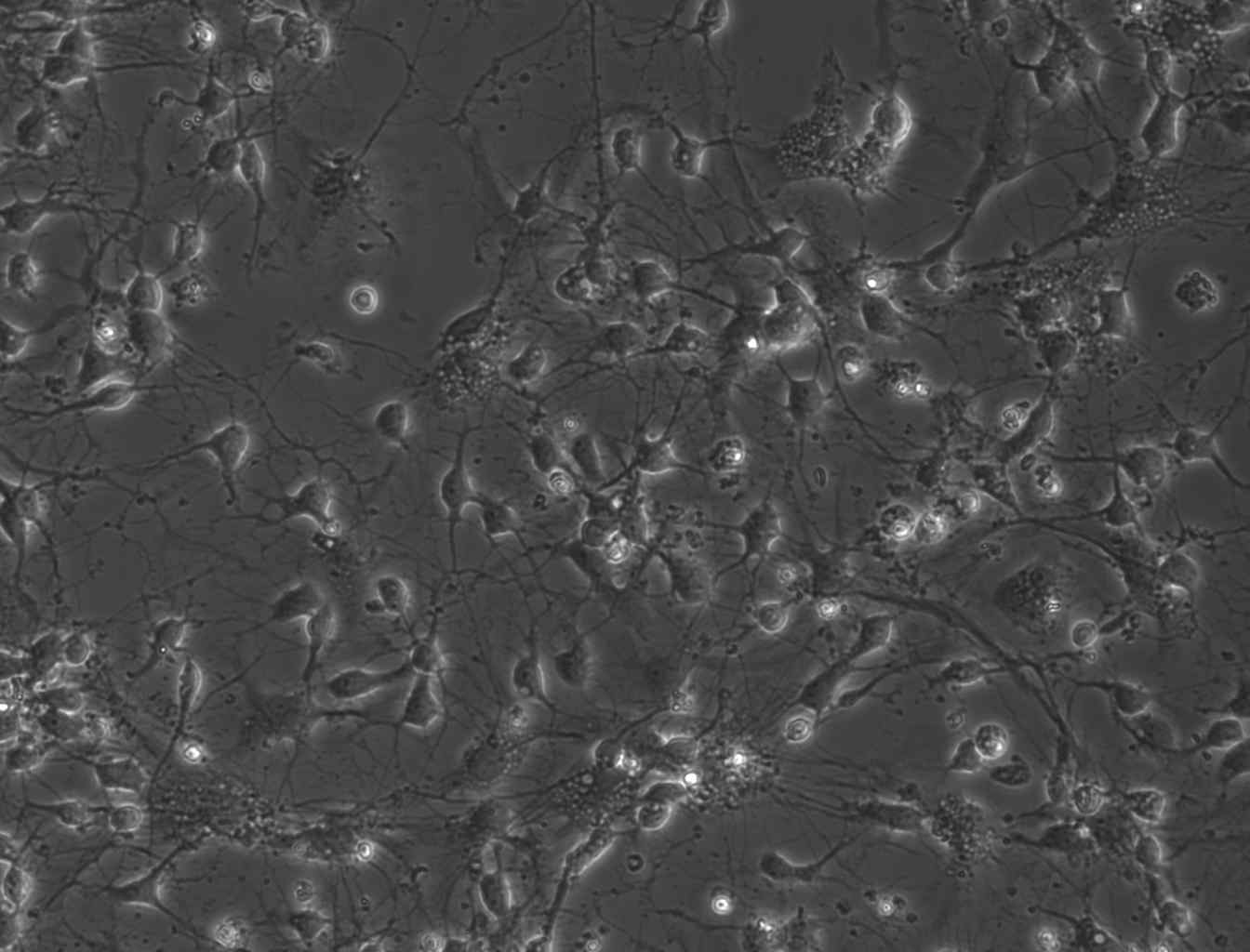 새끼 쥐의 뇌 조직에서 추출된 세포를 배양한 뒤(4일째) 일반광학현미경으로 얻은 이미지