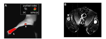 이미징 프로브가 표지된 수지상 세포의 림프절로의 이동 A. 근적외선 이미징 , B. MR 이미징