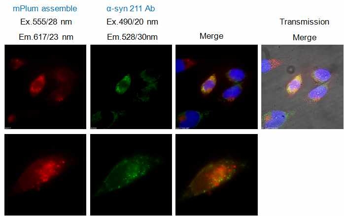 HeLa 세포내 자기결합 mPlum 형광단백질과 ?-syn의 형광 이미지