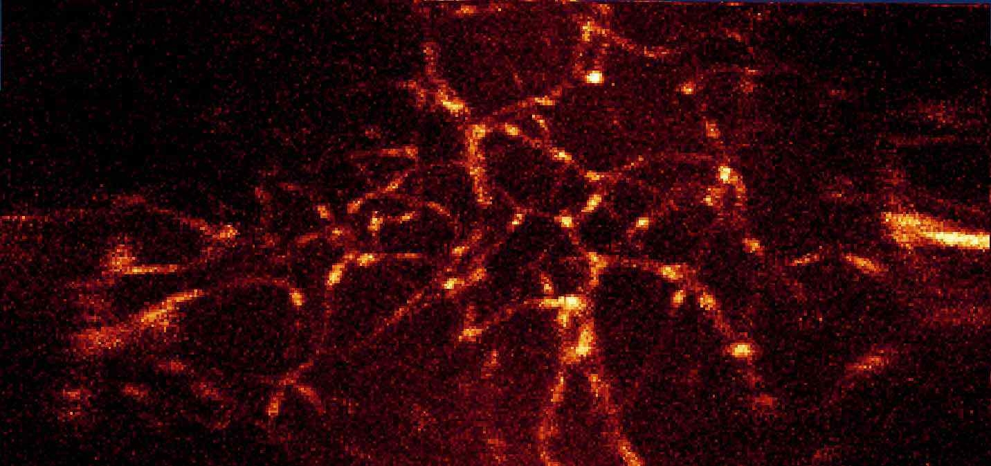 Handheld dual-axes confocal 현미경 이미지