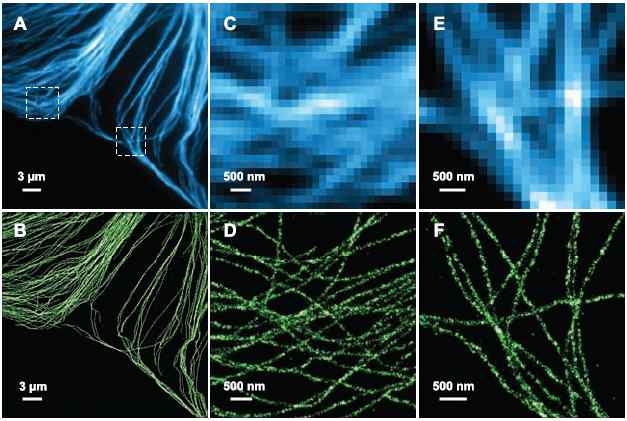 Mammalian cell 안의 microtubules의 일반 면역 형광이미지(A)와 STORM 이미지(B) (Mark Bates, et al. Science 317, 1749 (2007))