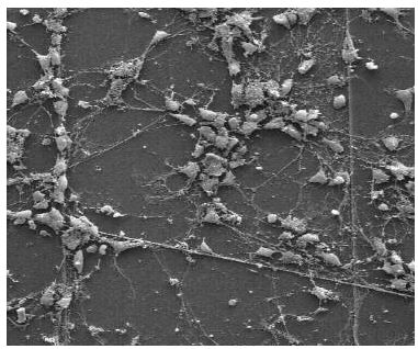 신경소자 상에서 배양된 신경세포의 SEM사진