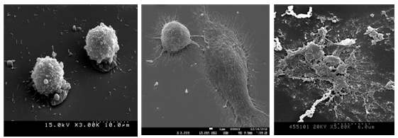 나노선 소자 상에 배양된 GH3 세포(좌), PC-12 cell line(중앙), NPC(우) 의 SEM 이미지