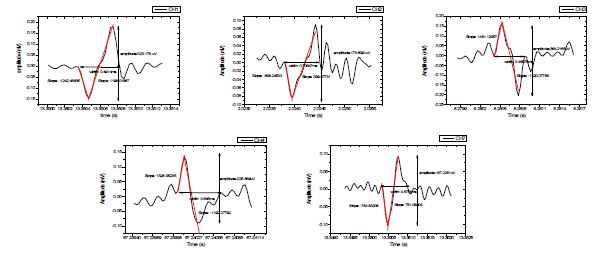 각 채널별 다른 시간에 검출된 action potential