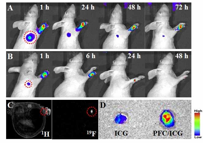나노에멀젼을 이용한 생체 이미징: A) 나노에멀젼 주입한 형광 이미징, B) ICG주입한 형광이미징, C) 19F MR 이미징, D) Ex vivo 형광 이미징