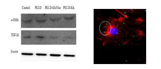 Western bloting을 통한 세포에서의 합성된 고분자/siRNA complex의 효과 (a) 및 세포 사진 ( red: surface desmin green: siRNA, blue: nuclei) (b)