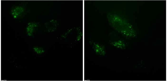 alpha-synuclein 단백질의 OPT 단백질 절편 발현 세포주 내 도입