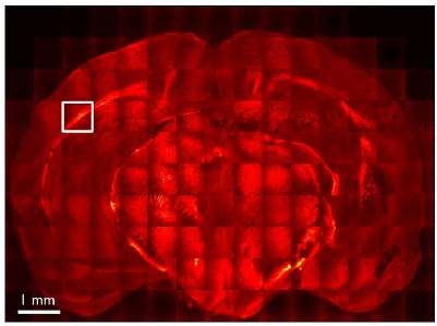CARS microscopy로 얻은 APP and PS1AD mouse의 뇌 이미지