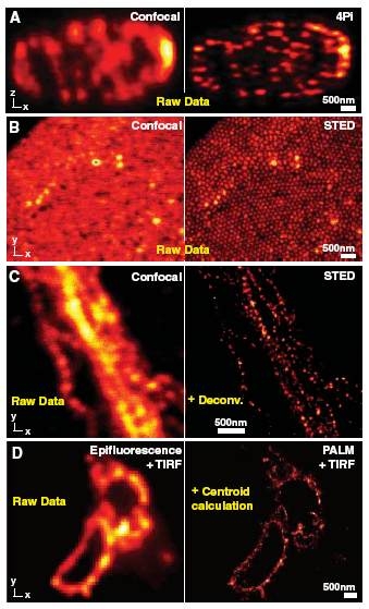 기존의 형광 이미징법(왼쪽)과 super-resolution 이미징법(오른쪽)의 비교 [S. W. Hell, Science 316, 1153 (2007)]