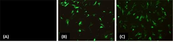 Expression of GFP gene in RBHT cells (A) control, (B) electroporation and (C) lipofectamine 2000 mediated