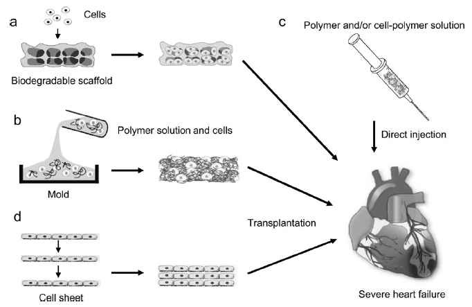 그림 6. 심부전에서 심장세포/조직공학적 치료 접근 방법
